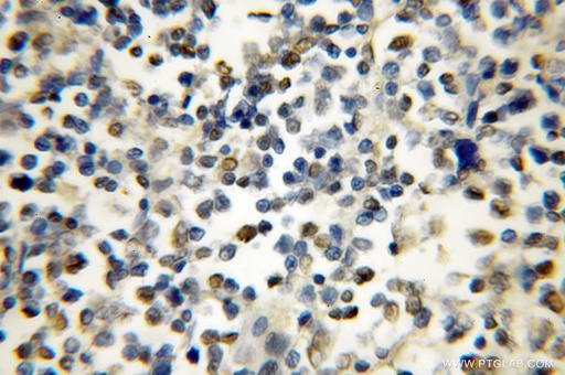 [12016-1-AP-150UL] IKZF1 Polyclonal antibody
