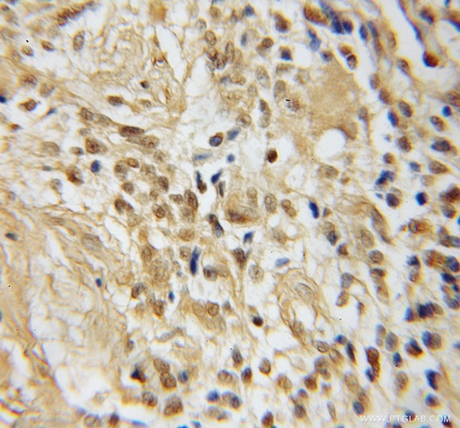 [12017-1-AP-20UL] TFAP4 Polyclonal antibody