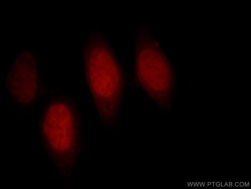 [12018-1-AP-150UL] BAF170 Polyclonal antibody