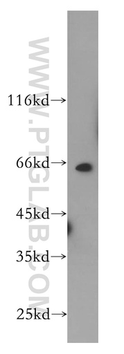 [12019-1-AP-20UL] PRCC Polyclonal antibody