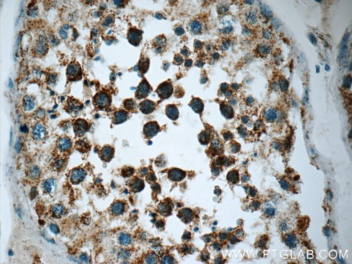 [12020-1-AP-20UL] SPATA7 Polyclonal antibody