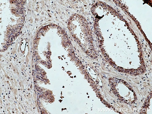 [12021-1-AP-150UL] TBCE Polyclonal antibody