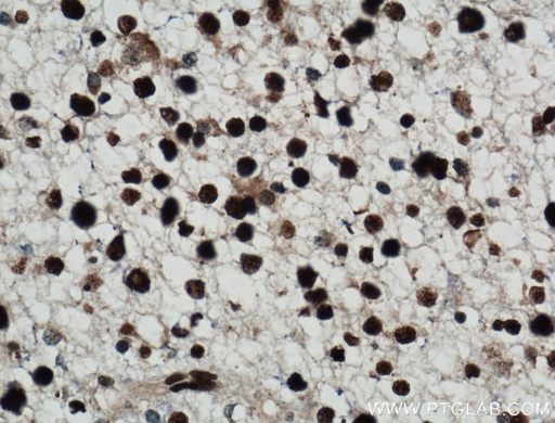 [12023-2-AP-20UL] NUCKS1 Polyclonal antibody
