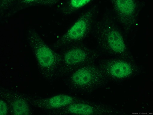 [12025-1-AP-150UL] HOXC10 Polyclonal antibody