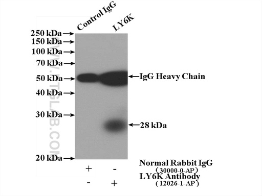 [12026-1-AP-150UL] LY6K Polyclonal antibody