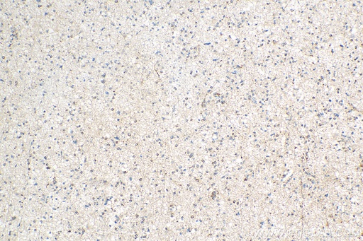 [12027-1-AP-150UL] STMN4 Polyclonal antibody