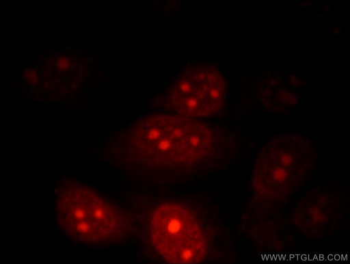 [12029-1-AP-20UL] POP1 Polyclonal antibody