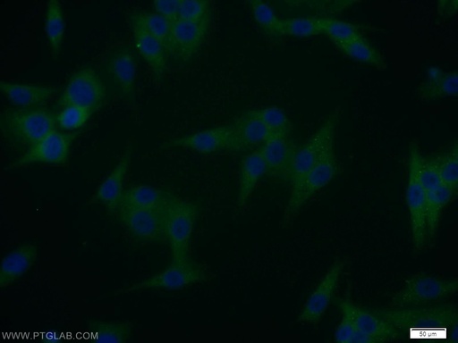 [12030-1-AP-150UL] WBP2 Polyclonal antibody