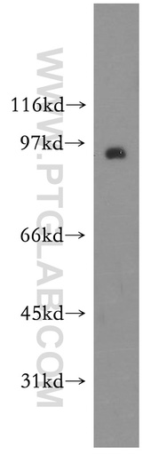 [12031-1-AP-20UL] Synaptotagmin-11 Polyclonal antibody