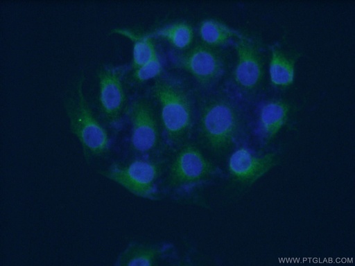 [12032-1-AP-150UL] KCNIP3 Polyclonal antibody