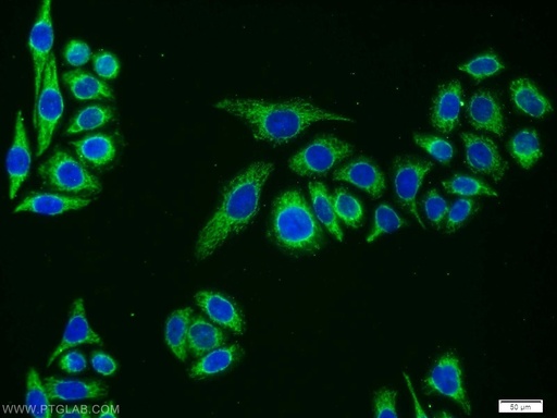 [12033-1-AP-150UL] TM7SF2 Polyclonal antibody