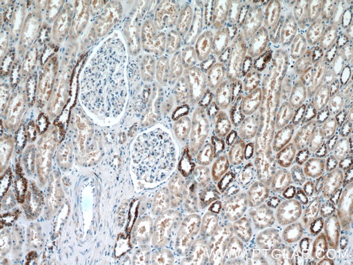 [12035-1-AP-150UL] KIF12 Polyclonal antibody