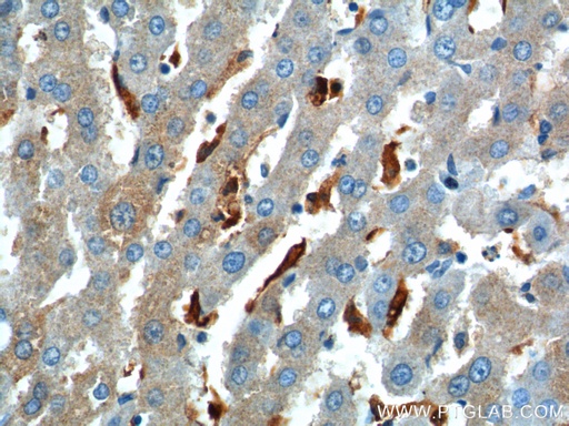 [12036-1-AP-20UL] CHI3L1/YKL40 Polyclonal antibody