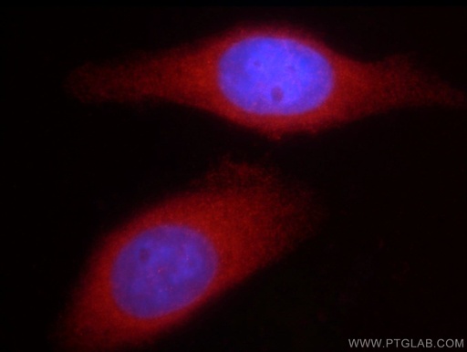 [12037-1-AP-20UL] DVL2 Polyclonal antibody