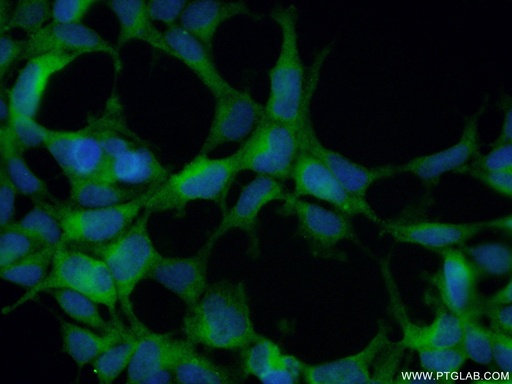 [12038-1-AP-150UL] HURP Polyclonal antibody