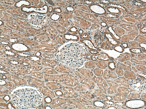 [12041-1-AP-150UL] DISP1 Polyclonal antibody
