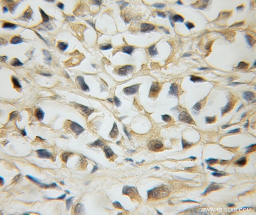 [12042-1-AP-150UL] MLX Polyclonal antibody