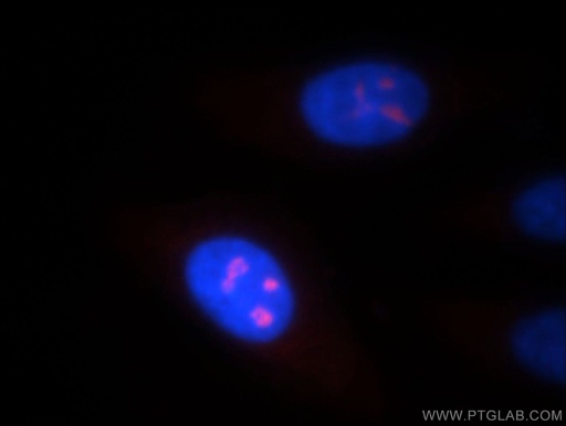 [12043-1-AP-20UL] NOL8 Polyclonal antibody