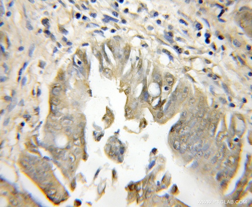 [12044-1-AP-150UL] PCSK7 Polyclonal antibody