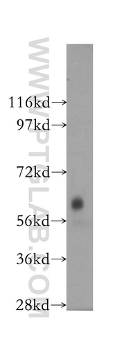 [12045-1-AP-20UL] DTNB Polyclonal antibody