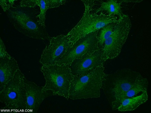 [12046-1-AP-20UL] Stomatin Polyclonal antibody