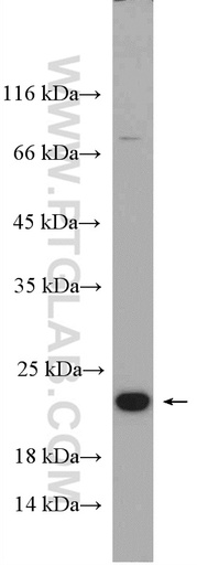 [12049-1-AP-150UL] CBFB Polyclonal antibody