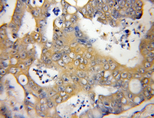 [12050-1-AP-150UL] SLU7 Polyclonal antibody