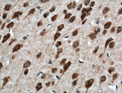 [12053-1-AP-150UL] PELI1 Polyclonal antibody