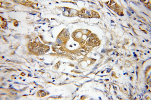 [12054-1-AP-150UL] PSMD3 Polyclonal antibody