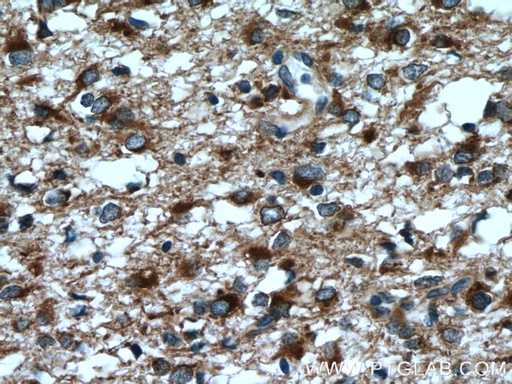 [12055-2-AP-150UL] RTN3 Polyclonal antibody