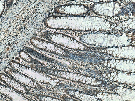 [12057-2-AP-150UL] IP6K1 Polyclonal antibody