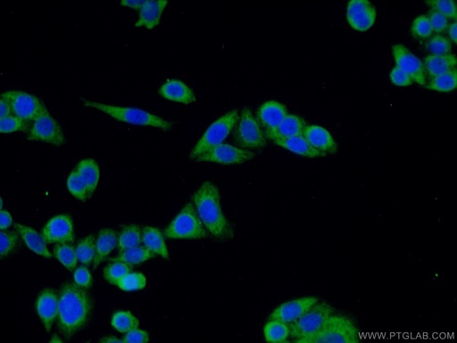 [12058-1-AP-20UL] ODF2 Polyclonal antibody