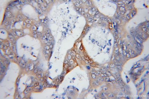 [12059-1-AP-150UL] PSMD14/POH1 Polyclonal antibody