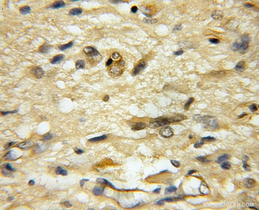 [12060-2-AP-20UL] USP33 Polyclonal antibody