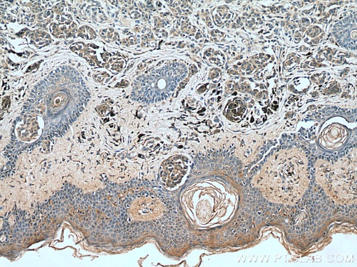 [12064-1-AP-150UL] IL-24 Polyclonal antibody