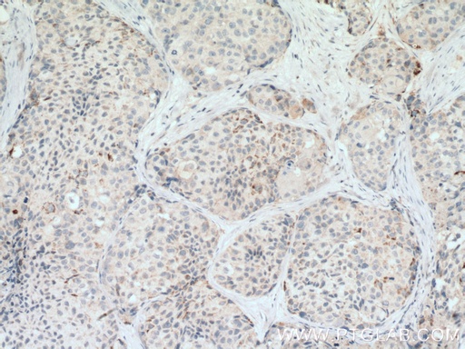 [12065-1-AP-20UL] RARRES3 Polyclonal antibody