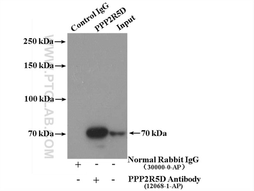 [12068-1-AP-150UL] PPP2R5D Polyclonal antibody