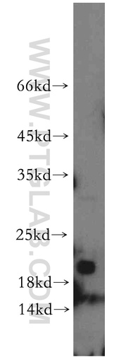 [12069-1-AP-150UL] NBL1 Polyclonal antibody