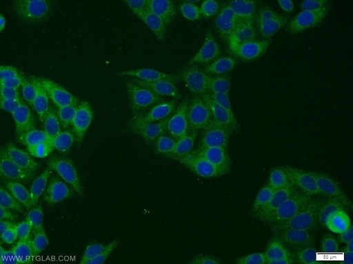 [12071-1-AP-150UL] STAT5B Polyclonal antibody