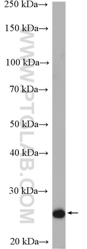 [12074-1-AP-20UL] TRAPPC4 Polyclonal antibody