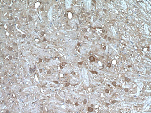 [12075-1-AP-20UL] PYGB Polyclonal antibody