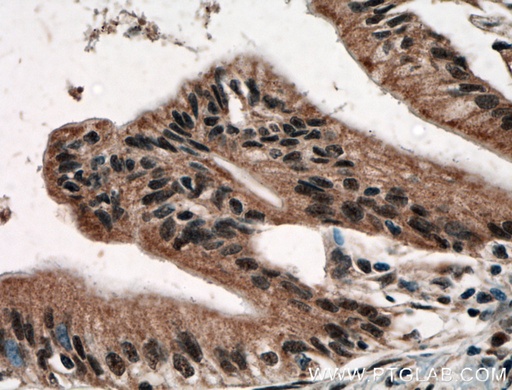 [12076-1-AP-150UL] USP48 Polyclonal antibody