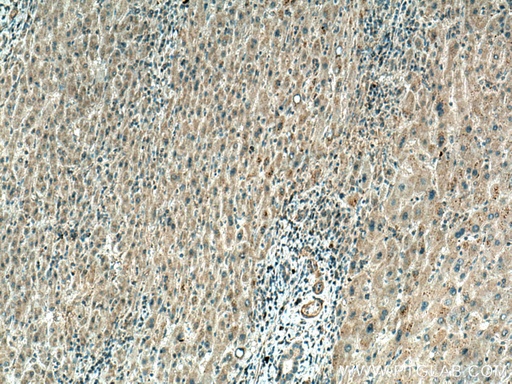 [12077-1-AP-20UL] TINAGL1 Polyclonal antibody