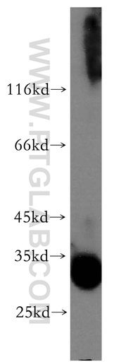 [12079-1-AP-20UL] TRA2A Polyclonal antibody
