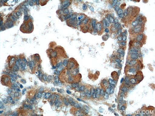 [12080-1-AP-20UL] VTCN1 Polyclonal antibody