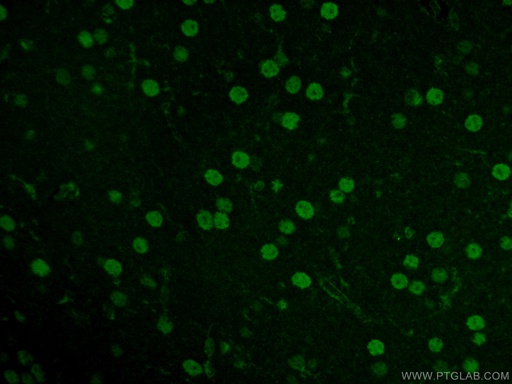 [12081-1-AP-20UL] NEUROD1 Polyclonal antibody