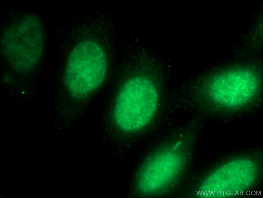 [12085-2-AP-20UL] HMG20A Polyclonal antibody