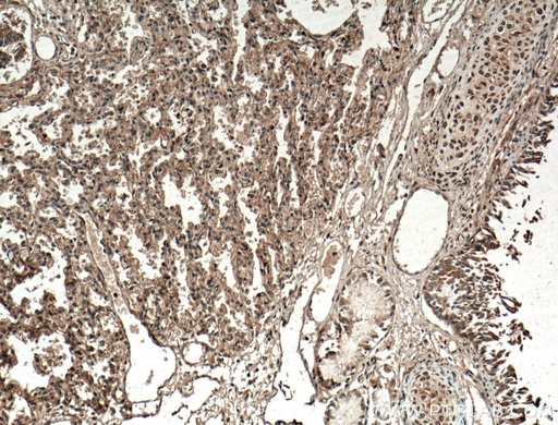 [12086-1-AP-20UL] SLC25A10 Polyclonal antibody