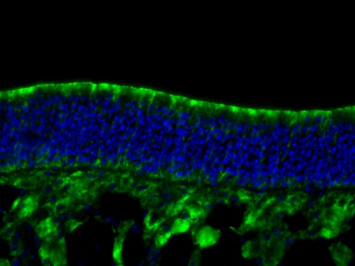 [12088-1-AP-20UL] REEP6 Polyclonal antibody