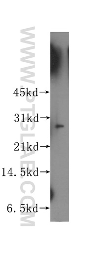 [12089-2-AP-20UL] APIP Polyclonal antibody